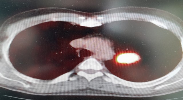 Prof. Dr. Şevket Özkaya: “Yaşayan her hücrenin sonu kanser”