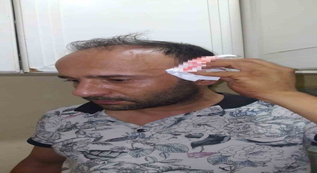 Kartalda ev sahibinin oğlu, kira zammını kabul etmeyen kiracısını darp etti