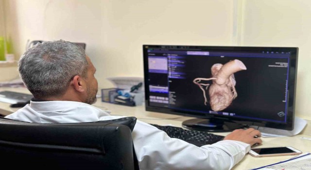Diyarbakırda kalp hastalıkları Kardiyak MR ile etkili ve hızlı teşhis ediliyor