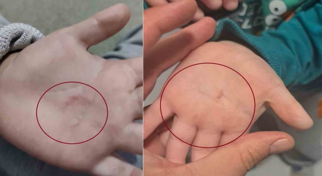Bandırma Belediyesinin kreşinde 4 yaşındaki çocuğa şiddet iddiası