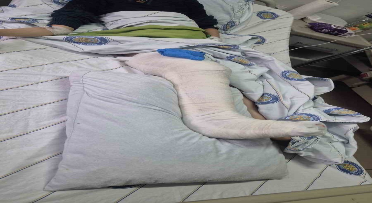 Diyarbakırda köpeklerden kaçan çocuğun bacağı kırıldı