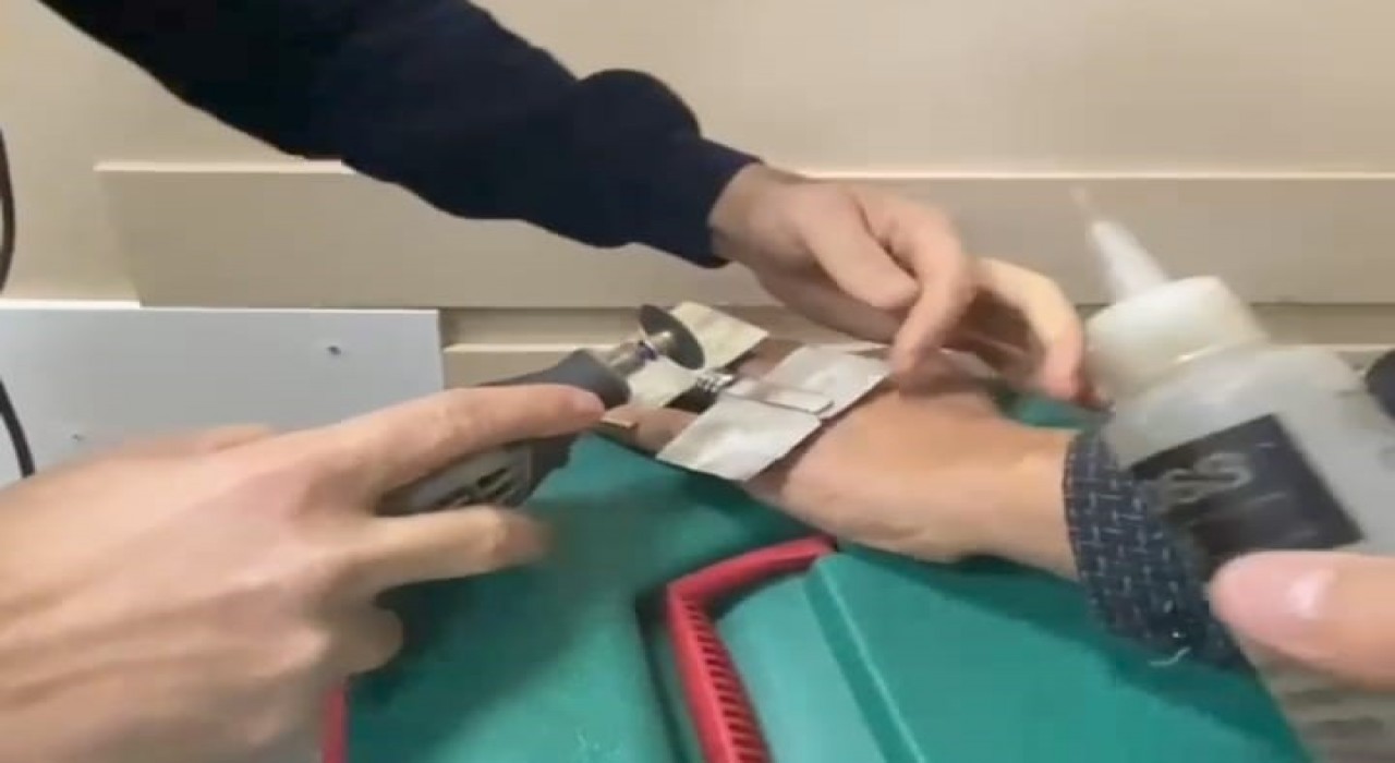 Parmağa sıkışan yüzüğü itfaiye keserek çıkardı
