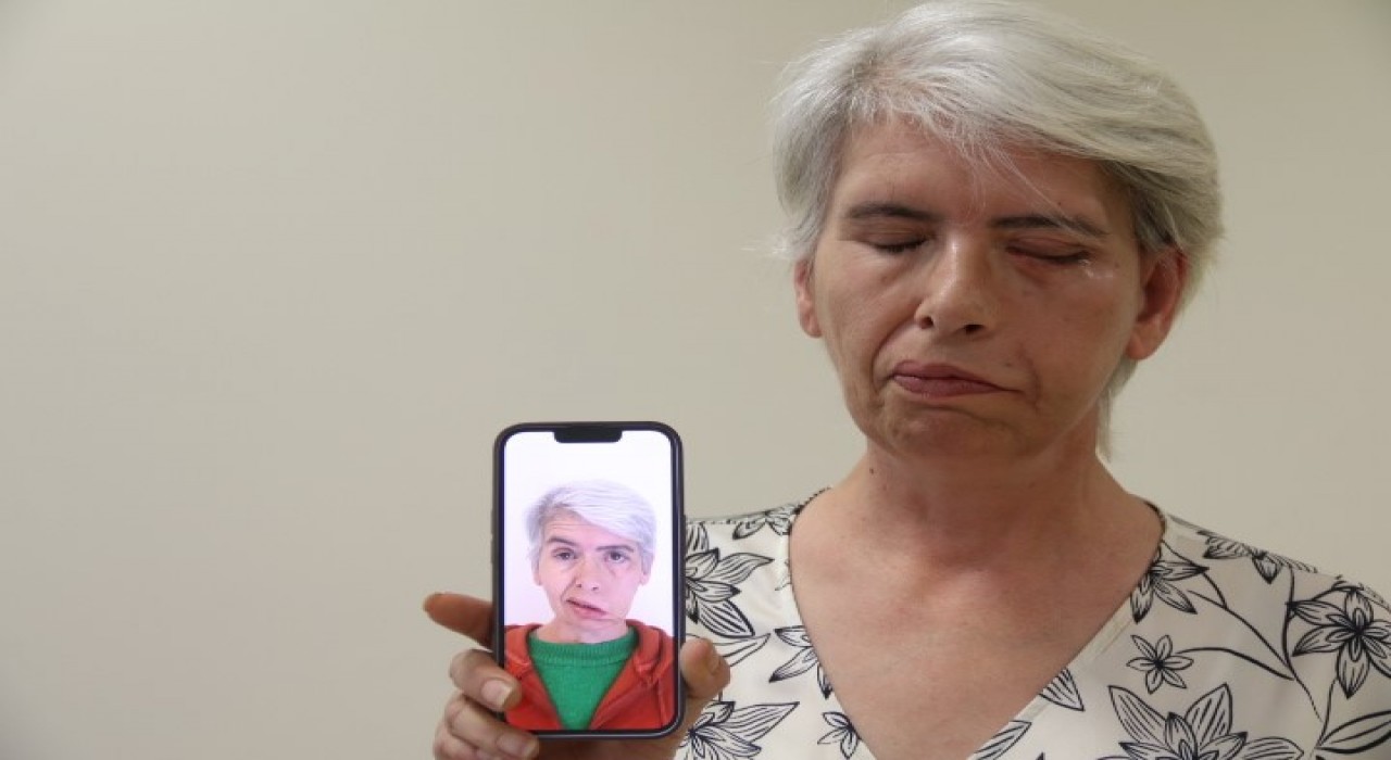 Sol gözünü 30 yıl sonra 24 ayar altınla yapılan tedavi sonucu kapattı