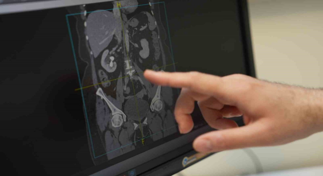 Erkek sağlığının sırrı sofrada: Beslenmeyle cinsel gücü artırın