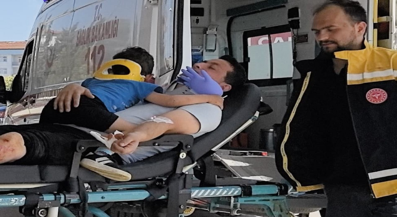 Kazada yaralanan çocuğu eldivenden yaptıkları balonla oyaladılar