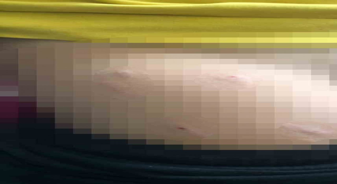 Sokak köpeği 5 yaşındaki çocuğa saldırdı