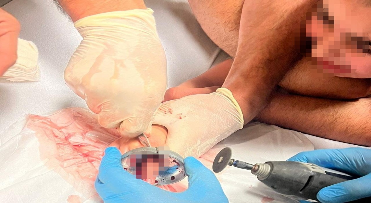 Bursada çocuğun parmağı çeşme aynasına sıkıştı