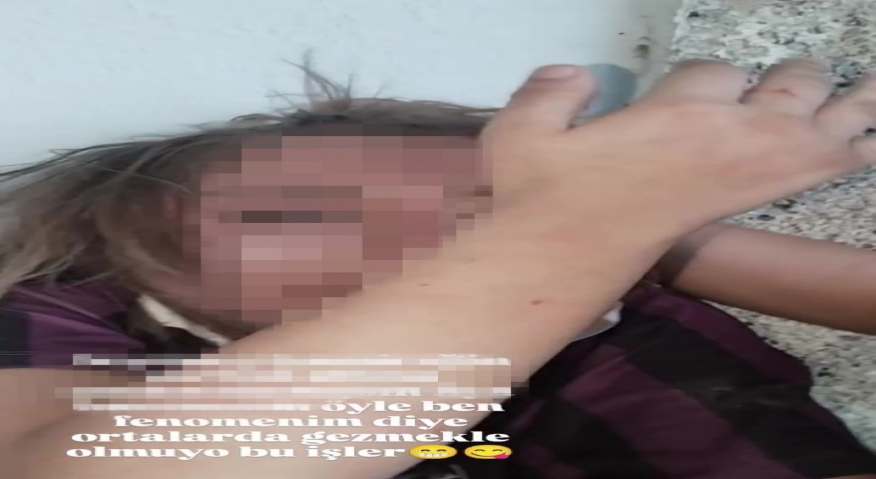 Genç kızı darp edip özür dilettiler, o anları sosyal medyada paylaştılar
