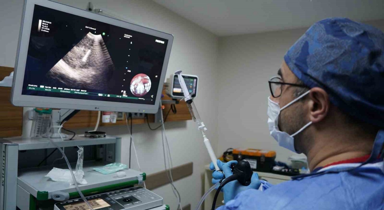 İEÜ Medical Point Hastanesi Akciğer Sağlığı Merkezinde EBUS ile ameliyatsız tanı