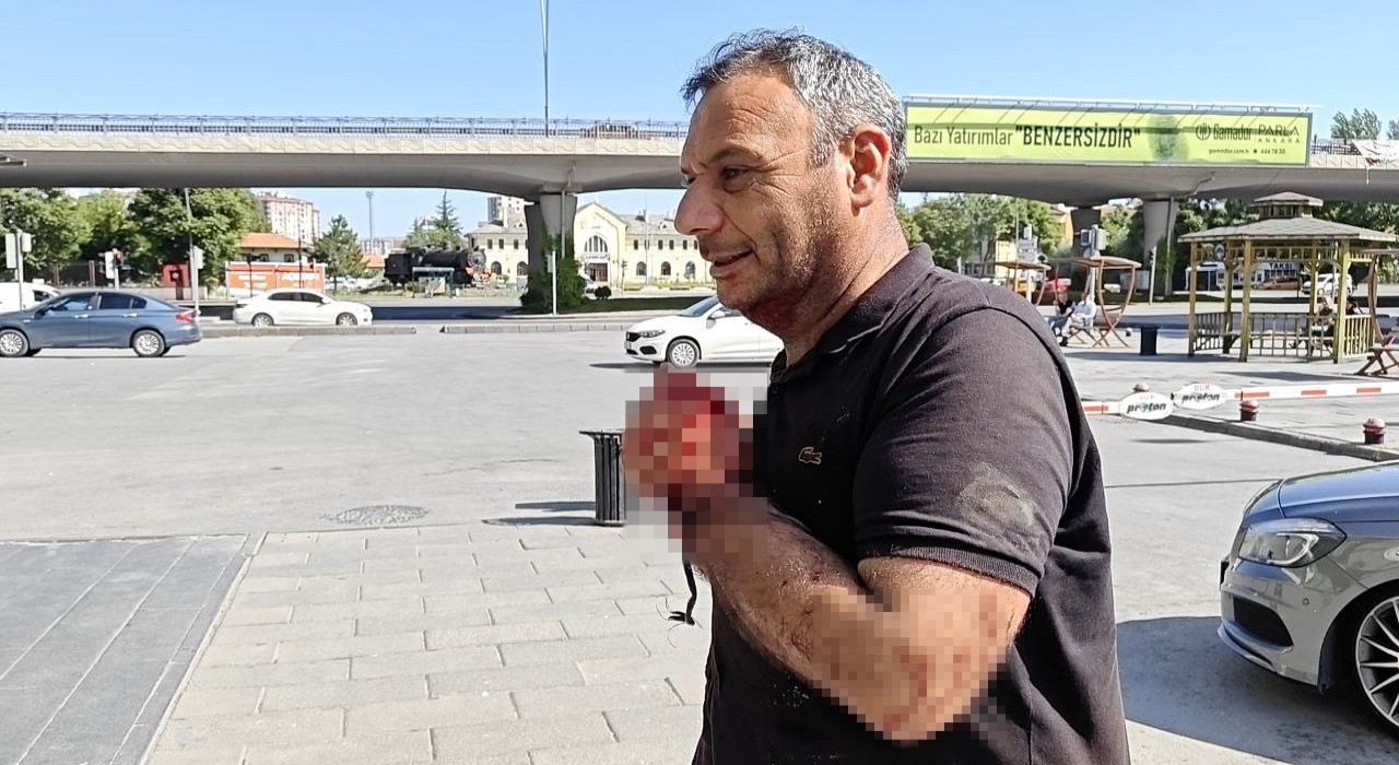 Kayseride acemi kasaplar soluğu acil serviste aldı