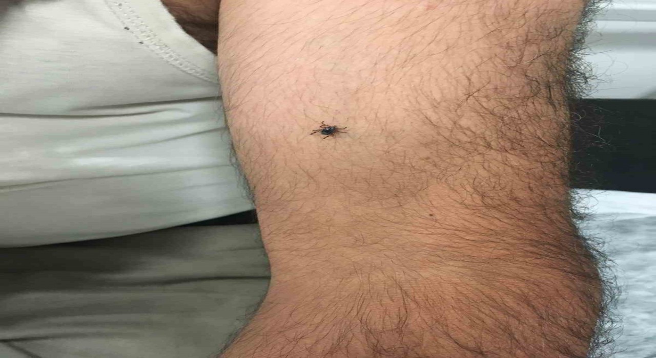 Kayserinin bir ilçesinde daha kene vakası