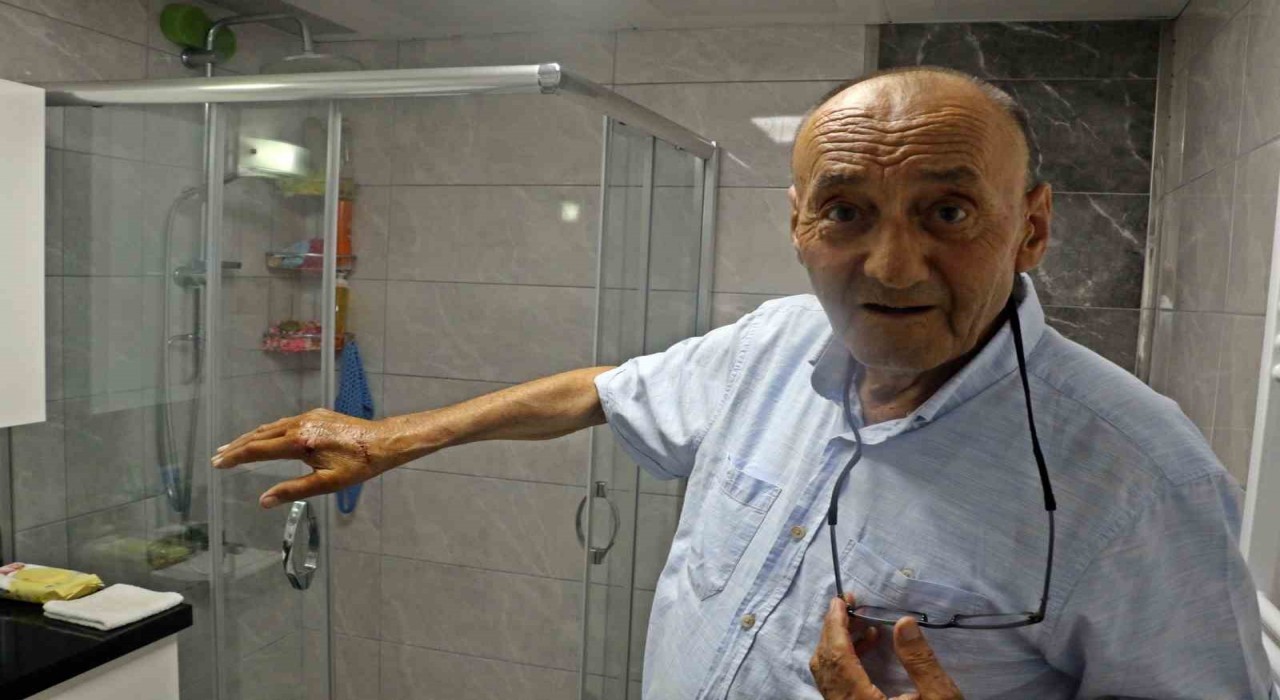 Patlayan duş kabininde yaralandı, 1 aydır direksiyon başına geçemiyor