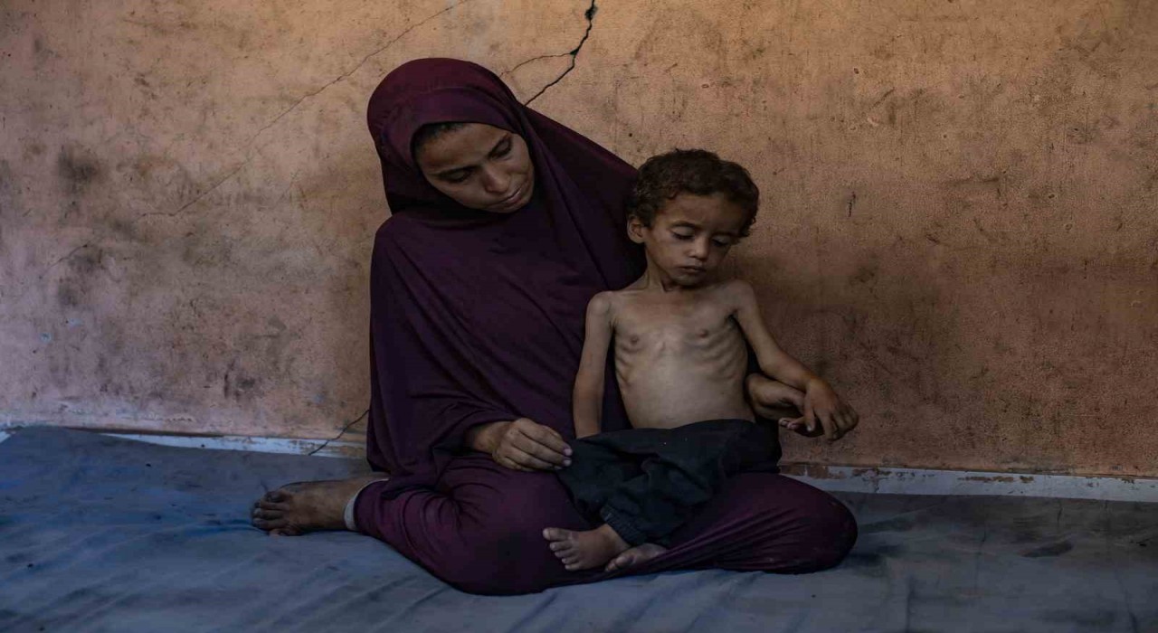 Gazzede açlık nedeniyle hayatını kaybedenlerin sayısı 113e yükseldi