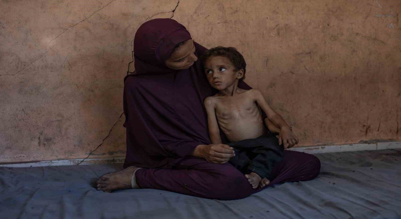 Gazzede açlık nedeniyle hayatını kaybedenlerin sayısı 127ye yükseldi