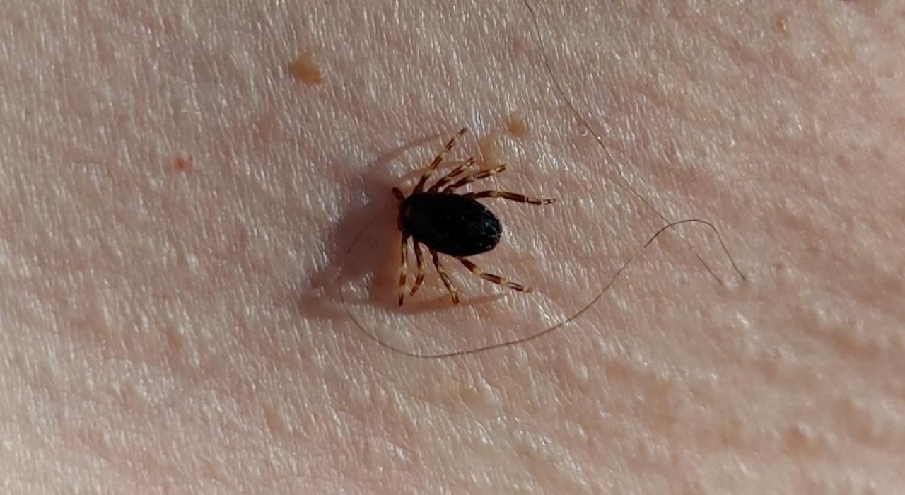 Prof. Dr. Gürdal Yılmaz: Bu yıl 21 KKKA vakası geldi bu hastalardan ikisi hayatını kaybetti