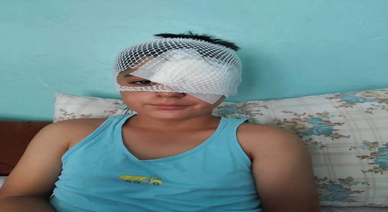 Şanlıurfada köpek saldırısından kaçan çocuğa otomobil çarptı