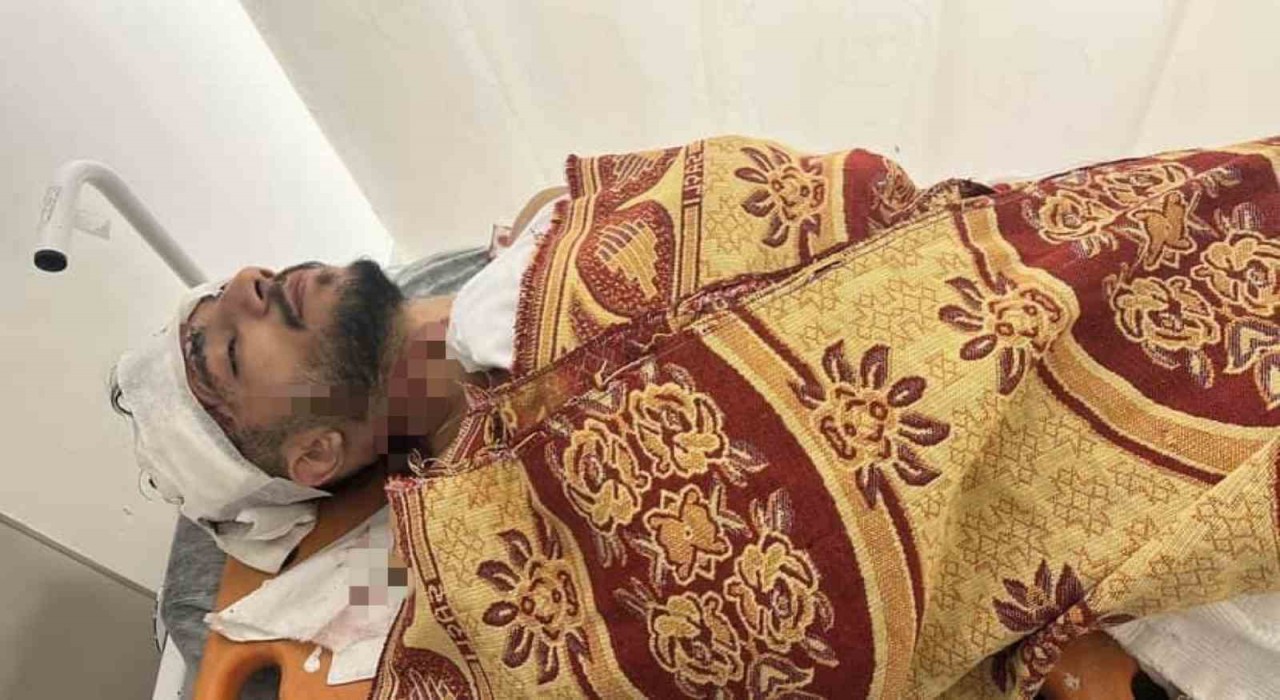 Arnavutköyde yol verme tartışması kaza ile bitti: Kamyonet sürücüsü taksiye çarpıp kaçtı