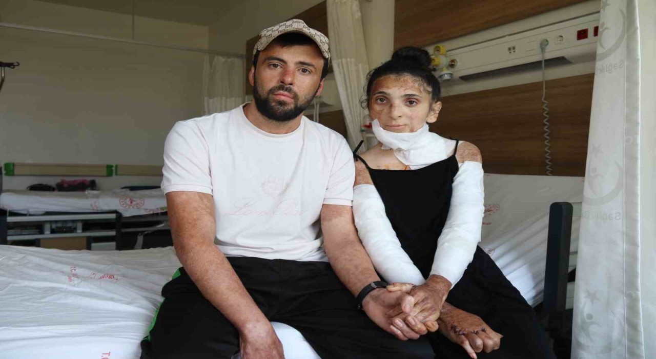 Azerbaycanlı çiftin doğal gaz patlamasında kapanan elleri, 3 yıl sonunda Eskişehirdeki tedaviyle kavuştu