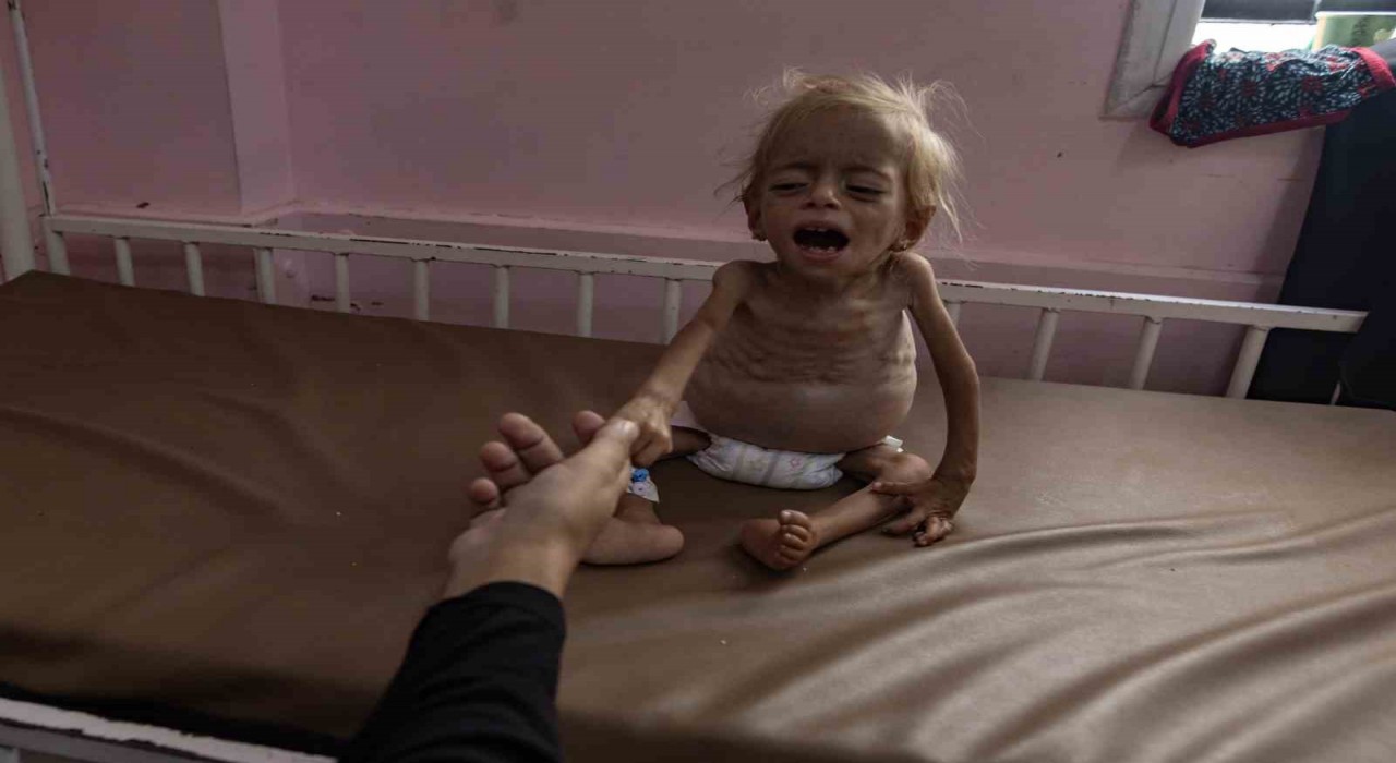 Gazzede 8 sivil daha açlık nedeniyle hayatını kaybetti