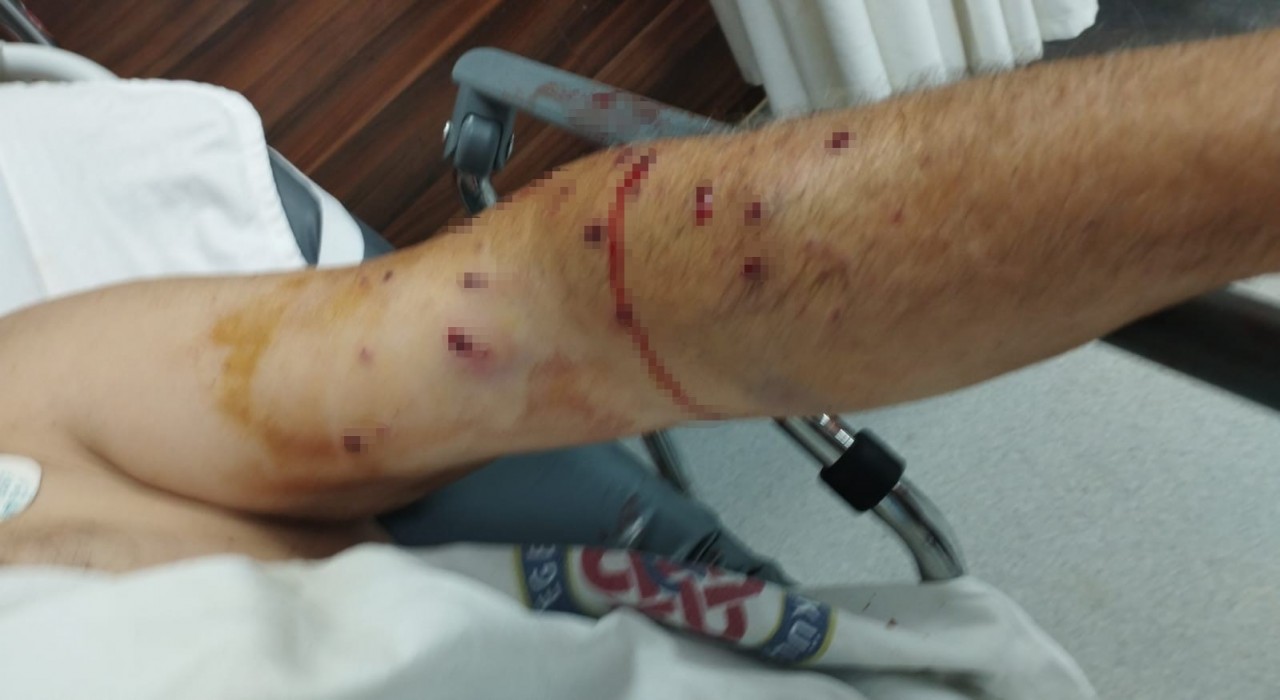 İzmirde tır sahibi 180 liralık kantar ücreti için çalışanı vurdu