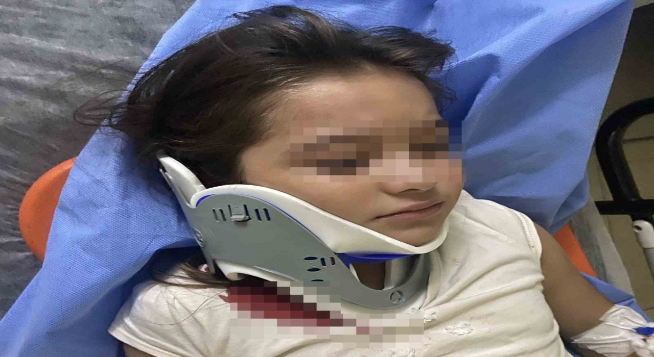 Orduda ters şeritten gelen scooter, 8 yaşındaki çocuğa çarptı