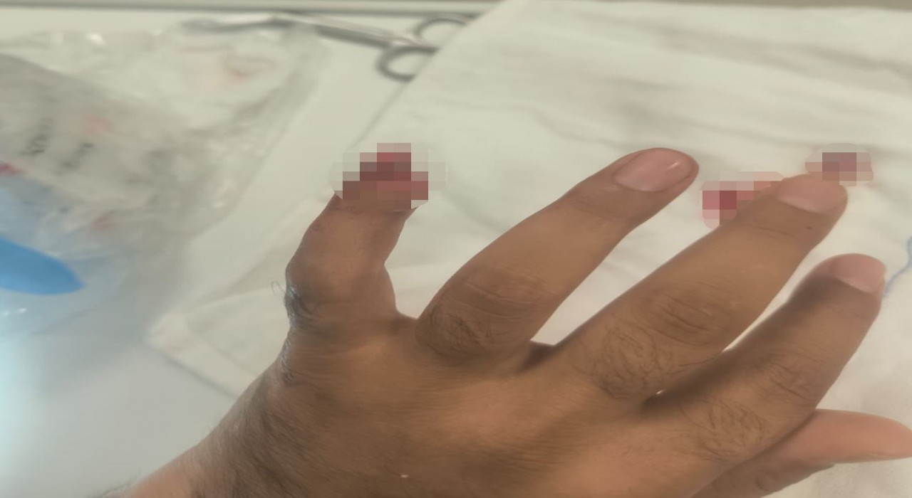 Uyuşturucuyla yakalanan şüpheli, polisin parmağını kopardı