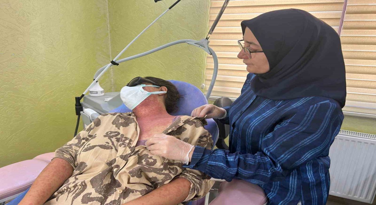 Vanda ‘beyazlatıcı krem faciası: 4 kişi hastanelik oldu