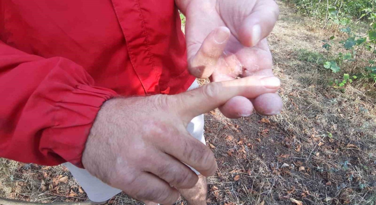 Ayının saldırısına uğrayan çiftçi dehşet anlarını anlattı: Parmağımı kopardı