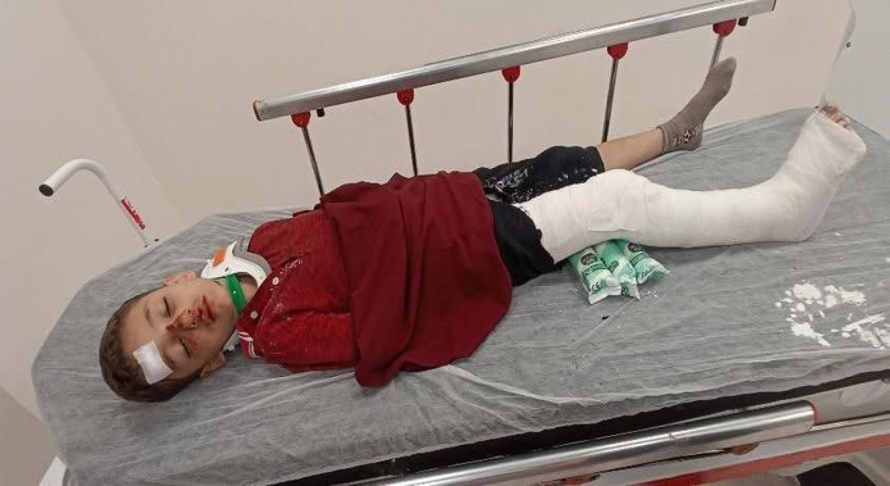 Başakşehirde 8 yaşındaki çocuğa trafiğe kapalı alanda motosiklet çarptı: Baba yardım istedi