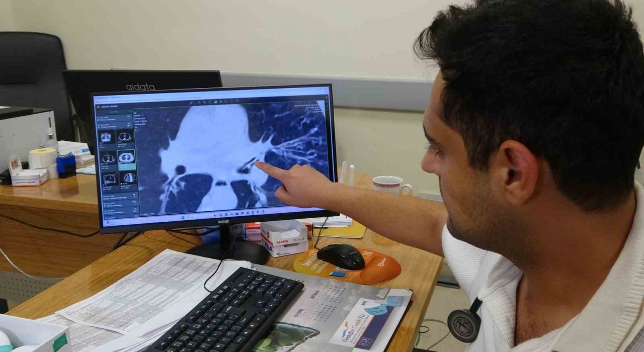 Kansersin, astımsın dediler: Akciğerinden kabak çekirdeği çıktı