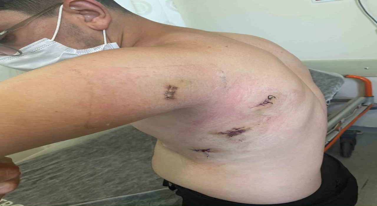 Kız kardeşini korumak isterken 5 yerinden bıçaklanmıştı: O anları anlattı: Ölümden döndüm