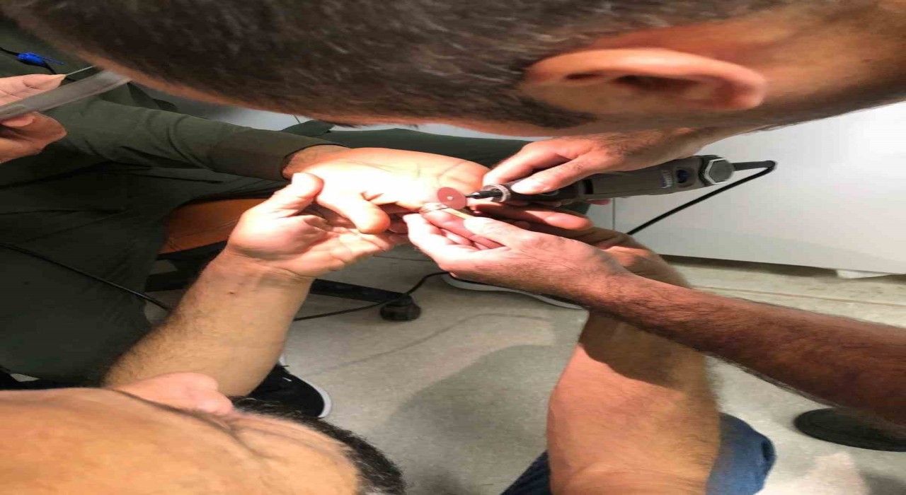 Mardinde bir kişinin parmağında sıkışan yüzük itfaiye ekiplerince çıkartıldı