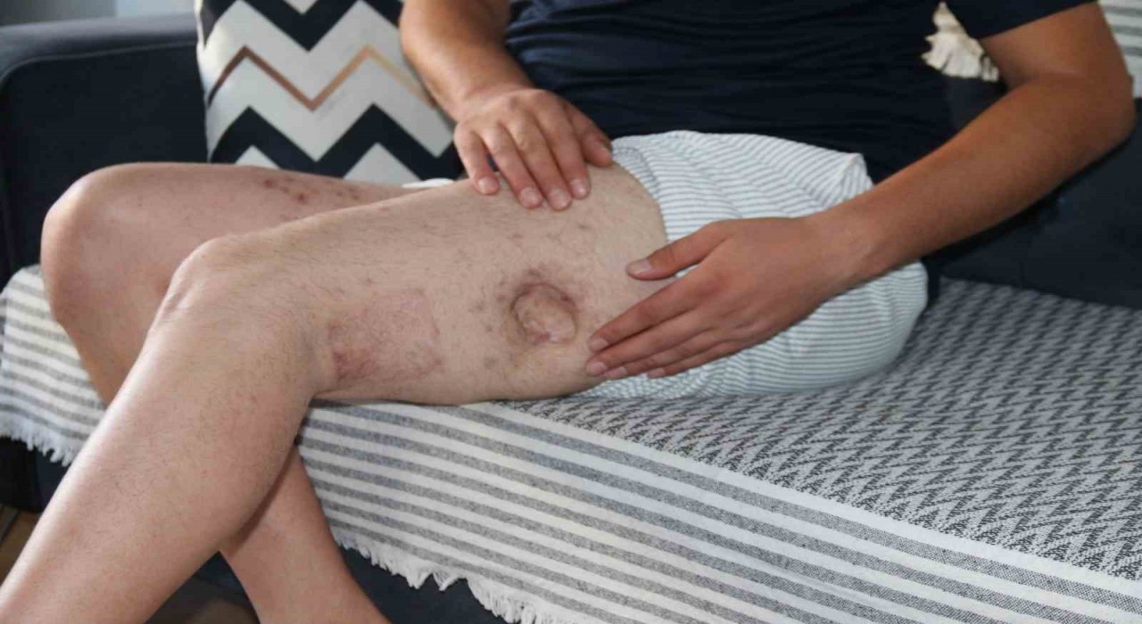 (ÖZEL) Kendisine iyilik yapmaya çalışan akrabasını önce vurdu, sonra da icra davası açtı