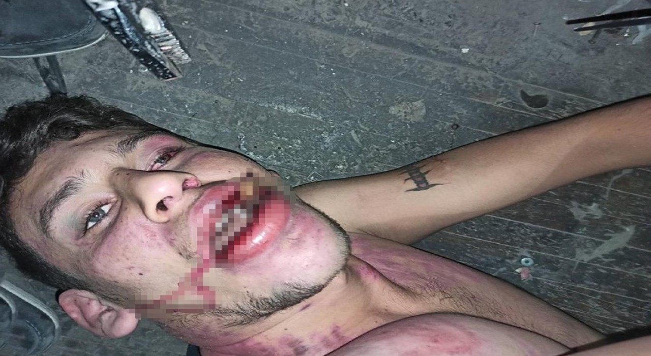 Antalyada Böcek yedirip dişlerimi kırdılar iddiasına 20 yıl hapis talebi