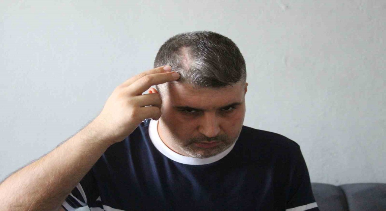 Beyzbol sopalı saldırgan dayı serbest kalınca yeğeni yardım istedi: Can güvenliğim yok