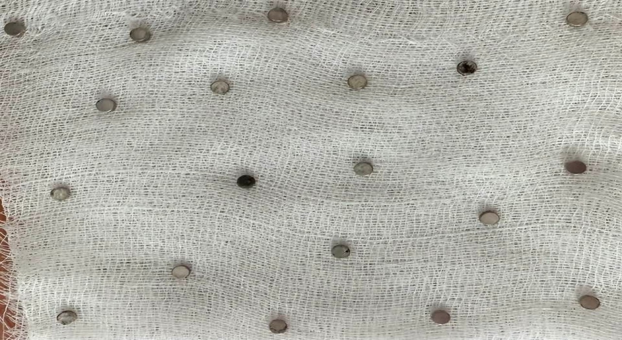 Çocuğun boğazından 19 adet mıknatıs çıkartıldı