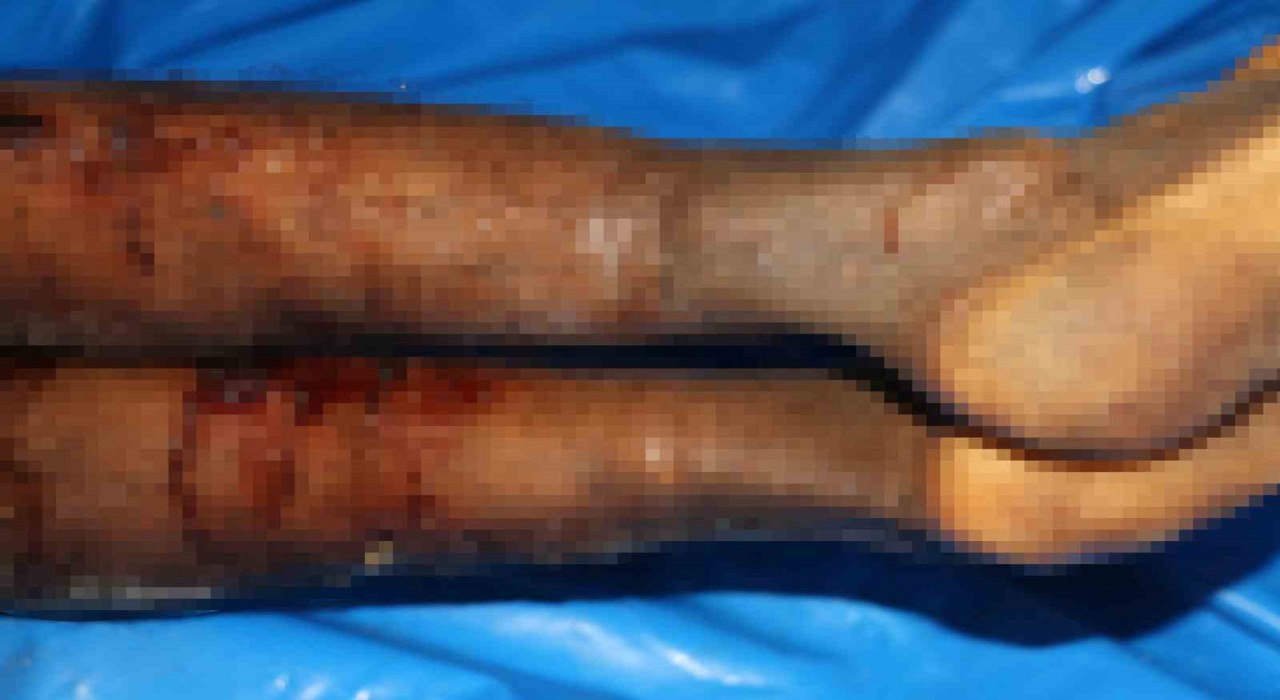 İsrailin iade ettiği cenazelerde işkence izleri görüldü