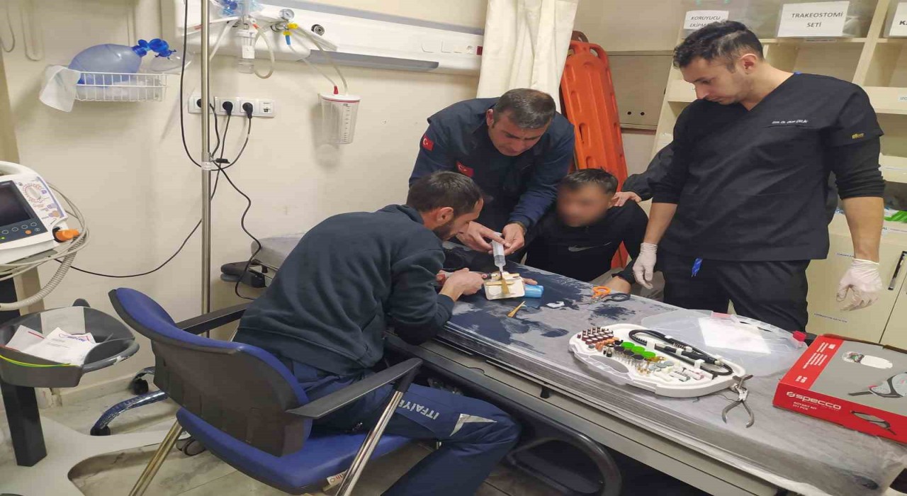 Parmağına sıkışan yüzüğü itfaiye çıkardı