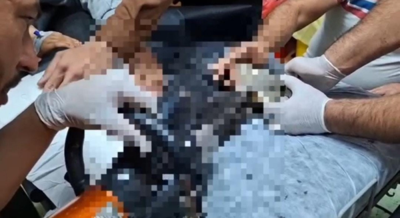 Tel Abyadta elini kıyma makinesine kaptıran çocuk Şanlıurfada tedavi altına alındı