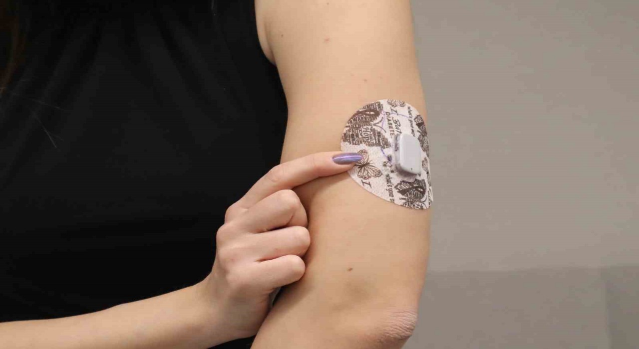 Diyabet tedavisinde yapay zeka destekli teknolojilerle Yapay Pankreas dönemi başlıyor