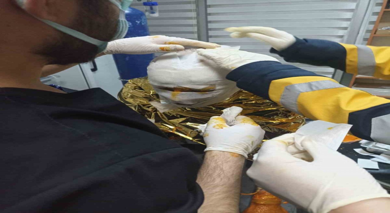 Erzincanda kömür ocağında yangın: 2 işçi yaralı