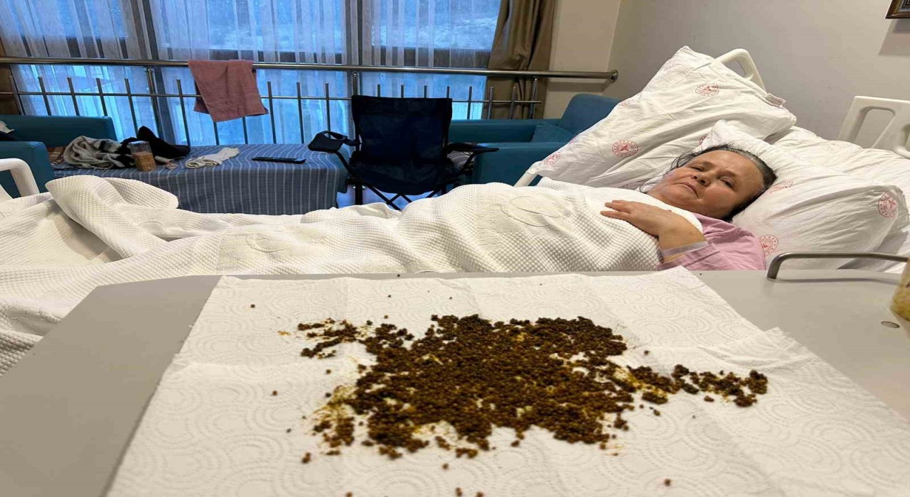 Hastadan çıkan taşları sayamadılar