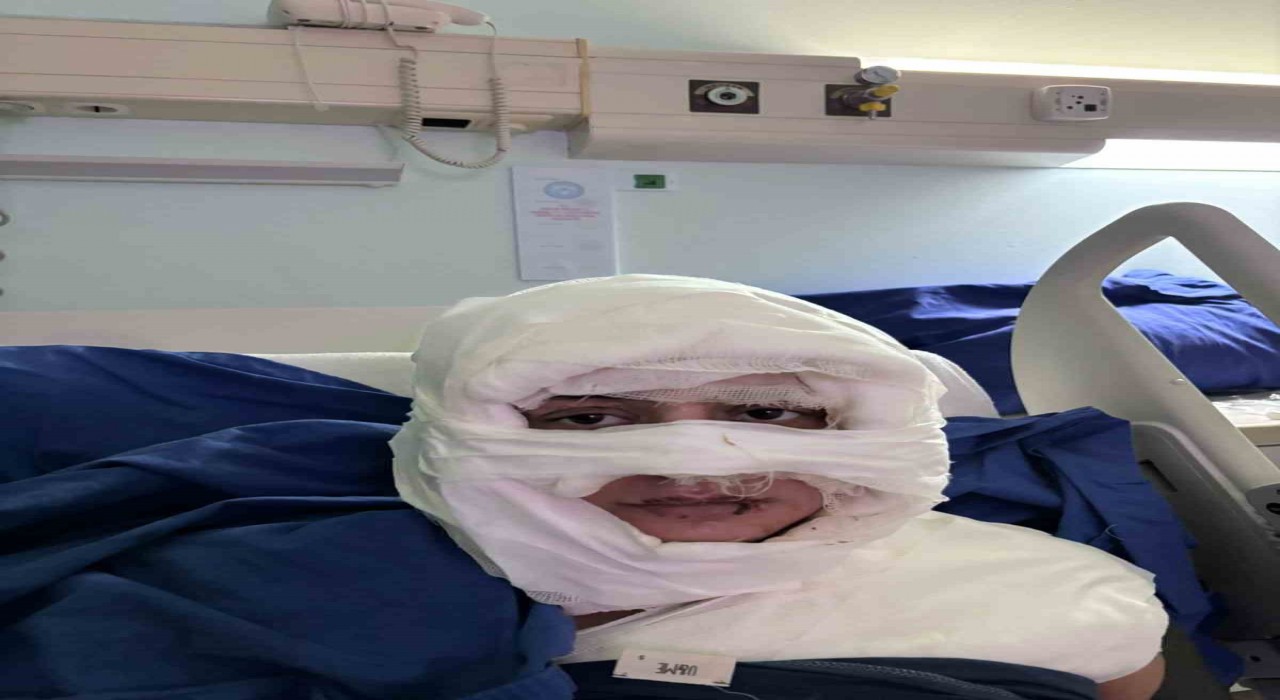 Kadıköyde akıl almaz olay: Genç kadın başka bir kadın tarafından ateşe verildi