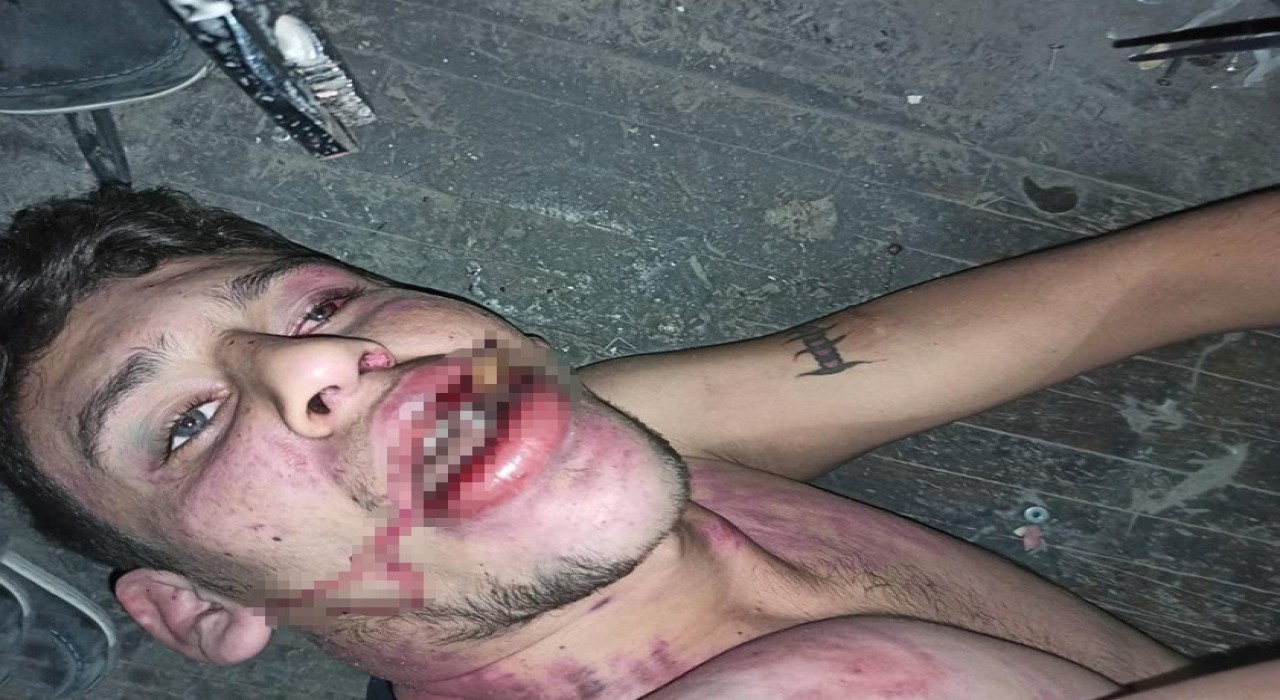 Hamam böceği yedirilen gencin dosyasında karar: Yağmadan beraat, hürriyeti tehditten 6 yıl 12 ay ceza