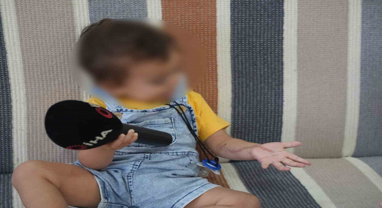 Iğdırda 1,5 yaşındaki çocuğun tomografi sonrası iki operasyon geçirdiği ve kolunda hasar oluştuğu iddia edildi