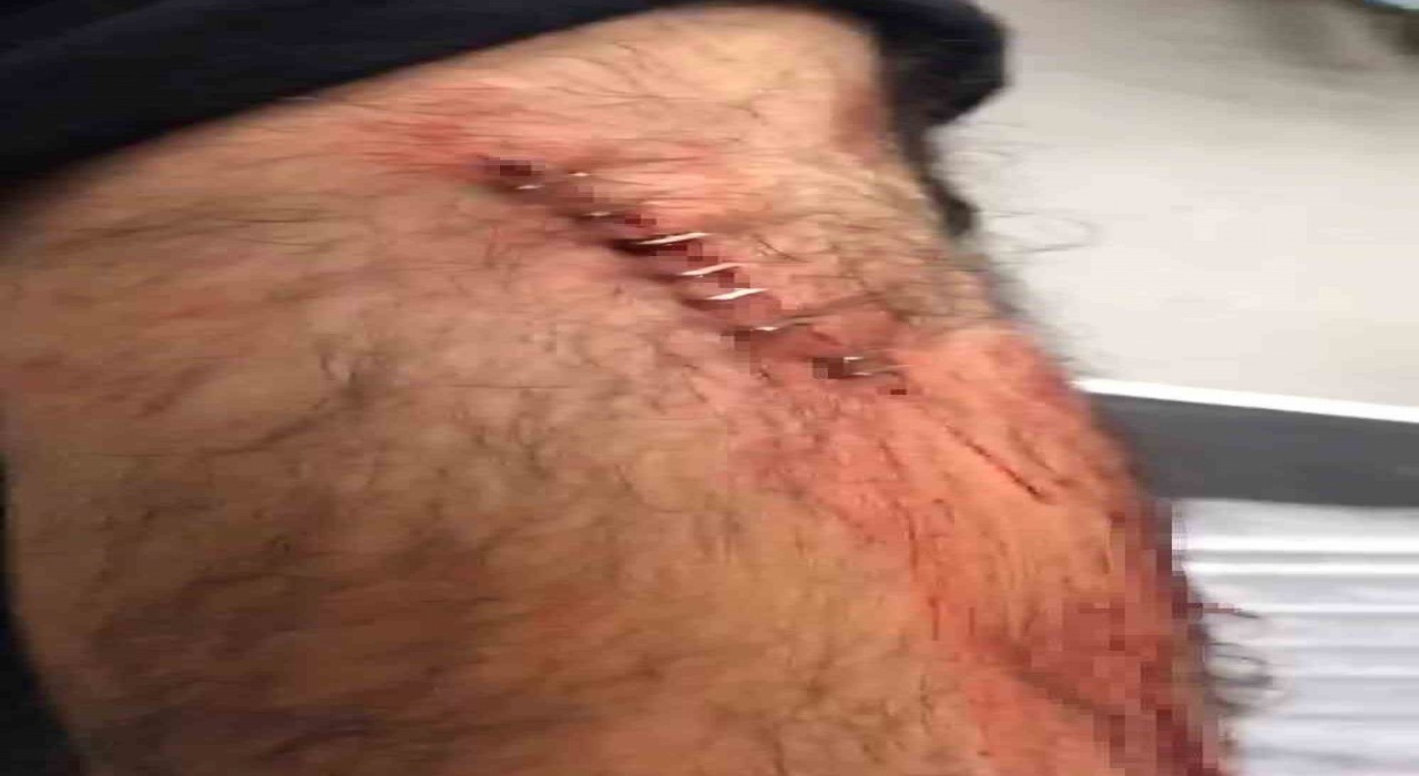 Şanlıurfada görev yapan öğretmene sokak ortasında jiletli saldırı