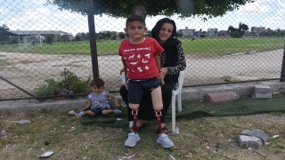 Adana’da 8 yaşındaki Muhammed protez bacaklarına kavuştu