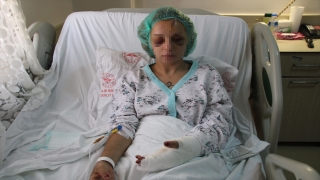 Mersin’de 2 şüpheli bıçakla yaraladıkları kadını kriko ve jantla da darbetmiş