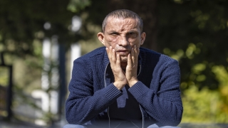 Nakille yüzleri gibi hayatları da değişti