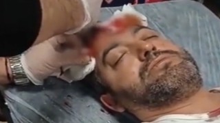 Avukata beyzbol sopalı saldırıda bulunan sanık ilk celsede tahliye edildi